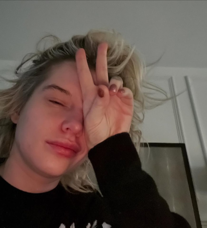 Helen Flanagan making a peace sign over her eye.
